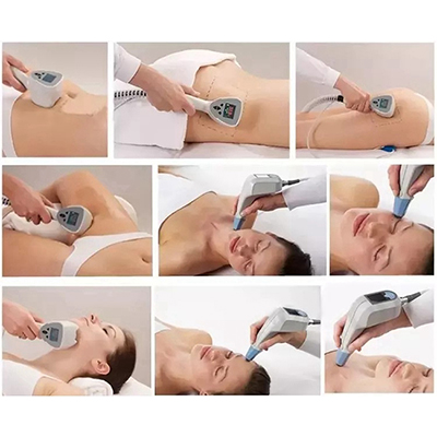 2 in 1 Exilift Ultra 360 Cellulite Removal RF Wrinkle Removal Machine