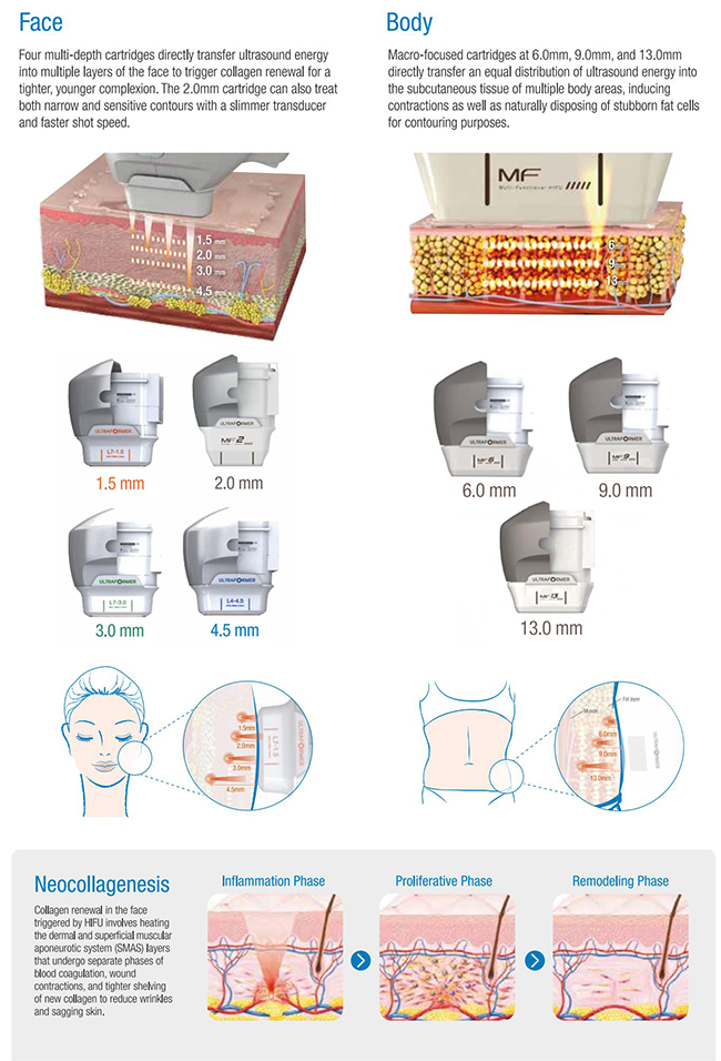 Hifu face lifting vaginal tightening beauty equipment