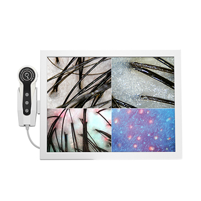 Portable HD Screen Professional Hair Tester Hair Follicle Detector