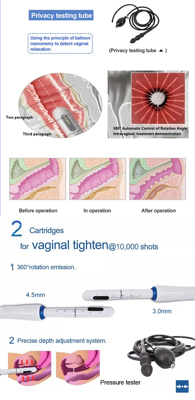 Hifu face lifting vaginal tightening beauty equipment