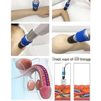 ESWT Electromagnetic Shockwave Therapy Extracorporeal Erectile Dysfunction Shock Wave Machine