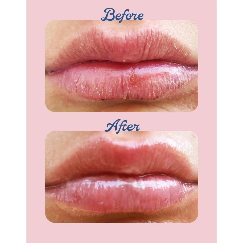 Lanolips The Original 101 Ointment Multipurpose Superbalm