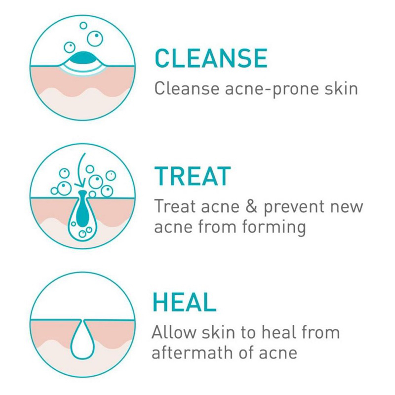 CeraVe Acne Foaming Cream Cleanser with 4% BPO for Acne Prone Skin