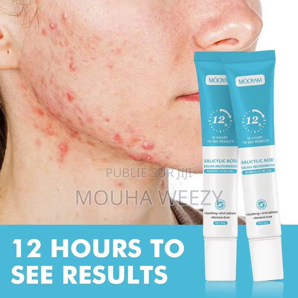 Gel Anti-Acné MOOYAM 