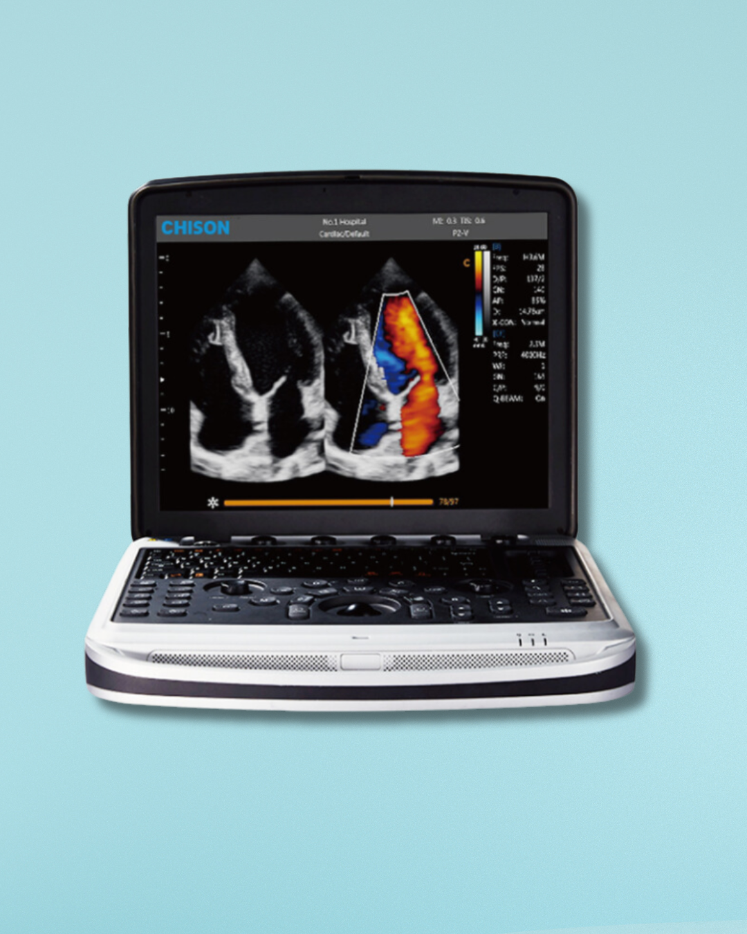ULTRASONIDO SONOBOOK 7 CHISON
