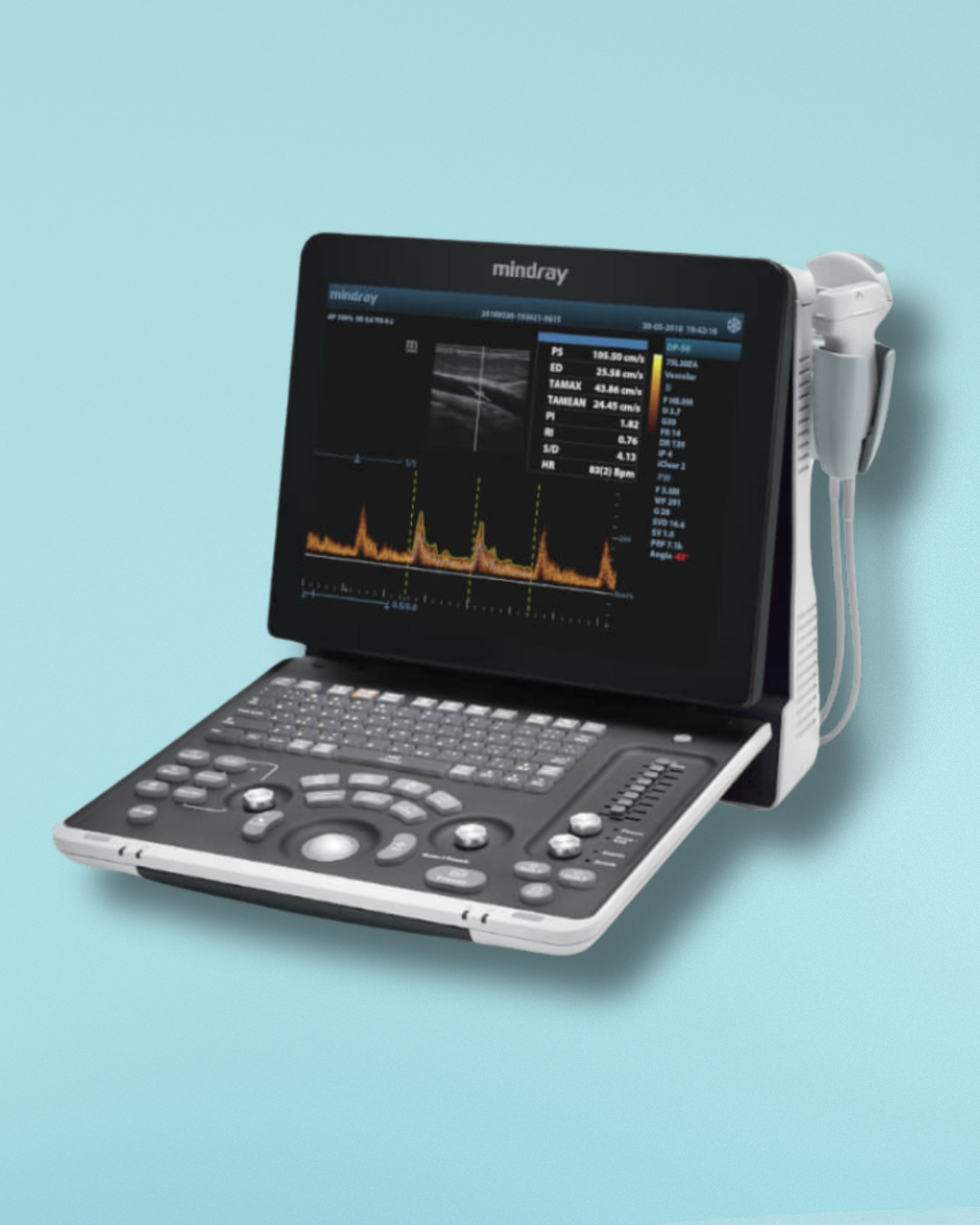 ULTRASONIDO MINDRAY DP-50 EXPERT