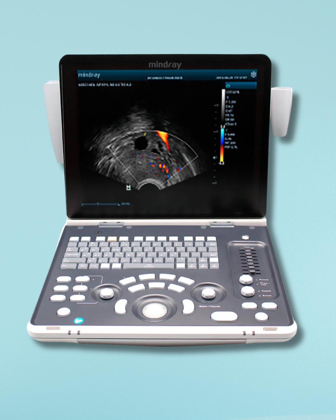 ULTRASONIDO PORTATIL MINDRAY Z50