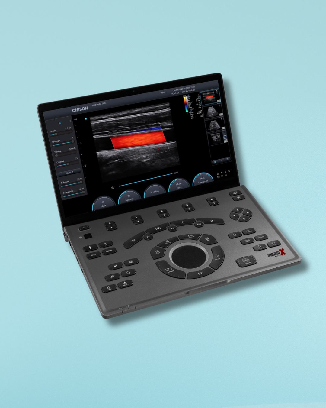 ULTRASONIDO SONOAIR 70 CHISON