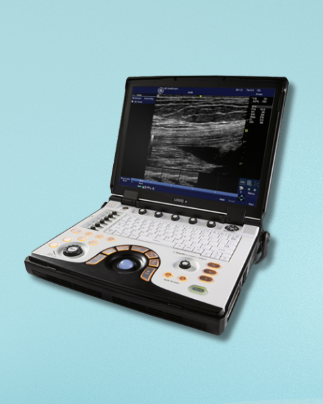 ULTRASONIDO NEXTGEN LOGIQ E ULTRASOUND