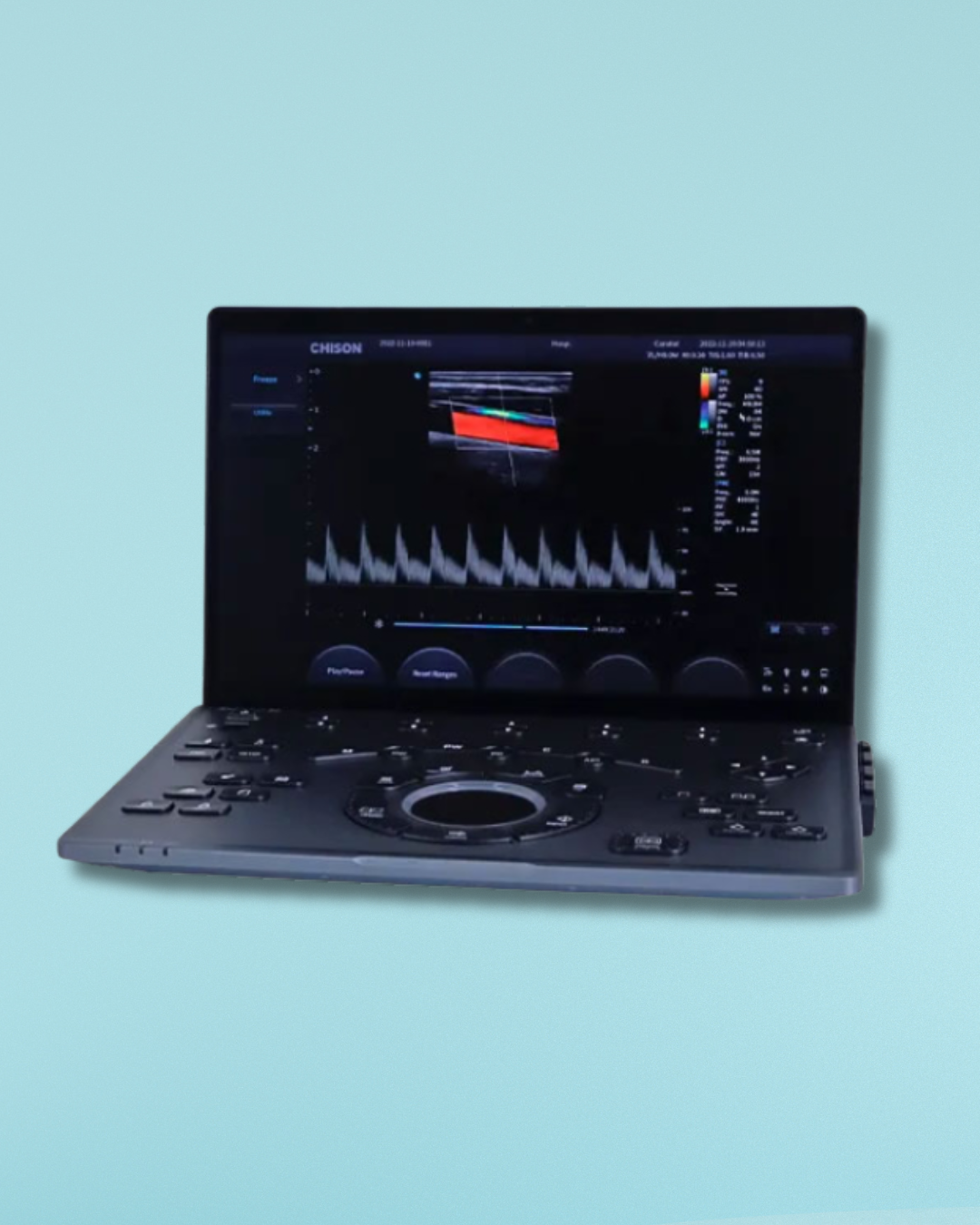 ULTRASONIDO SONOAIR 30 CHISON