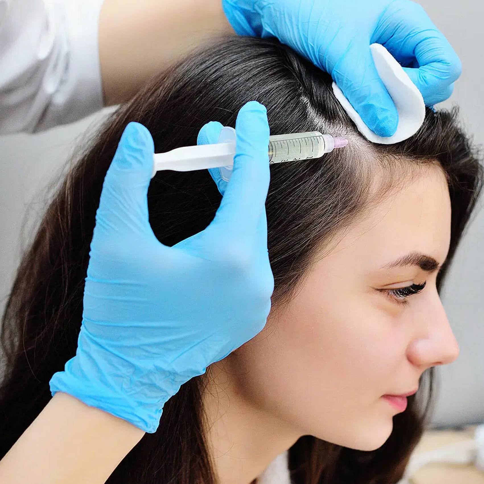PRP Therapy for Face and Hair