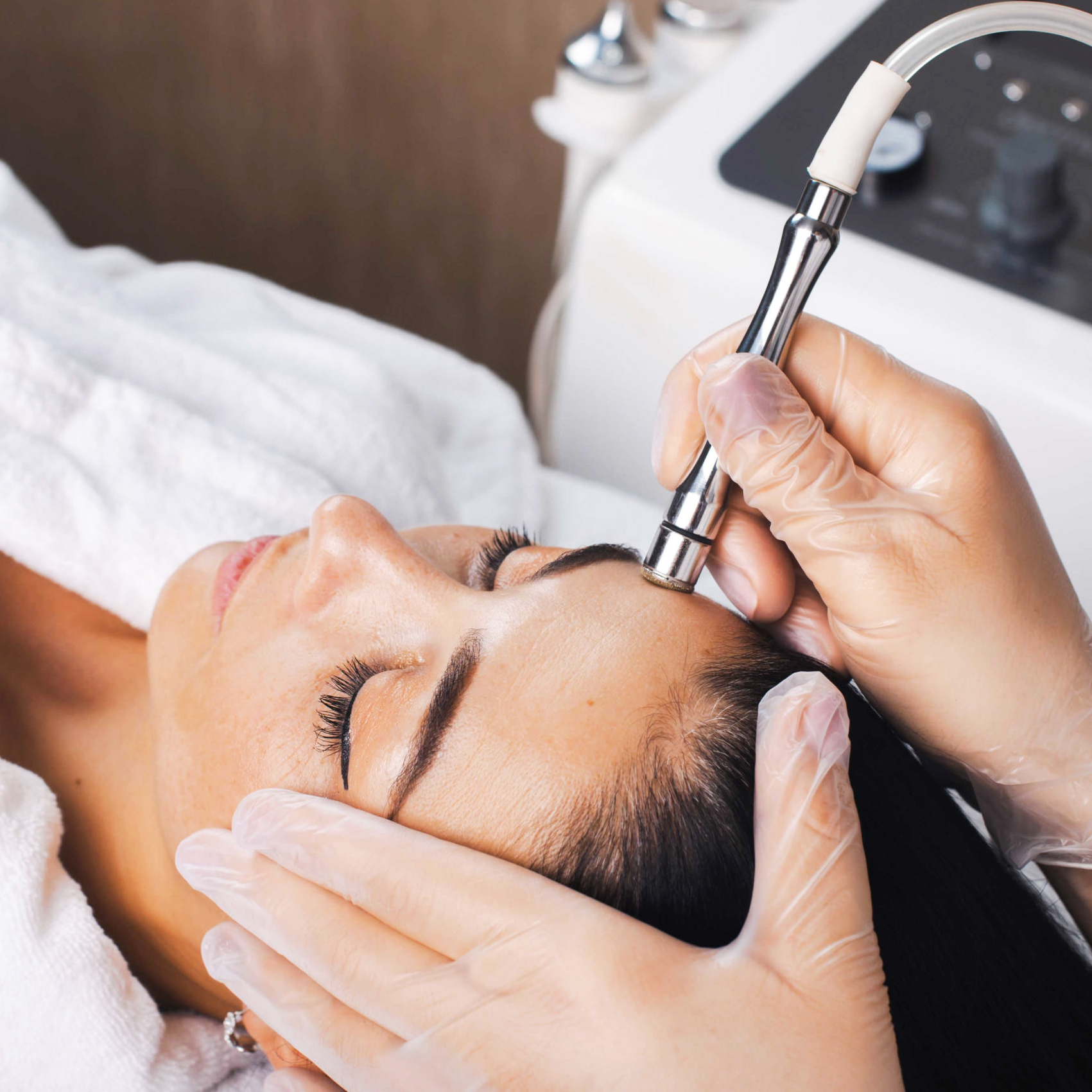 Microdermabrasion