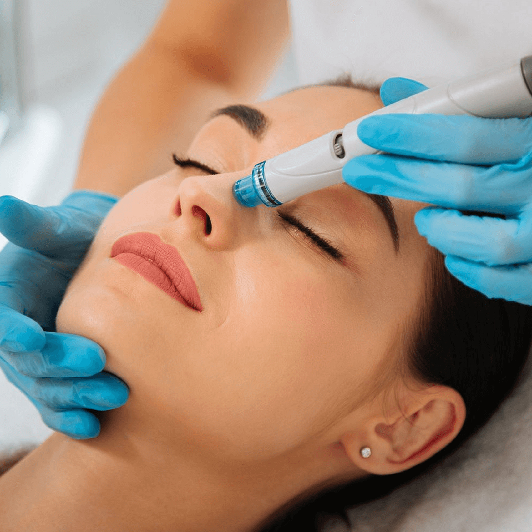 HydraFacial