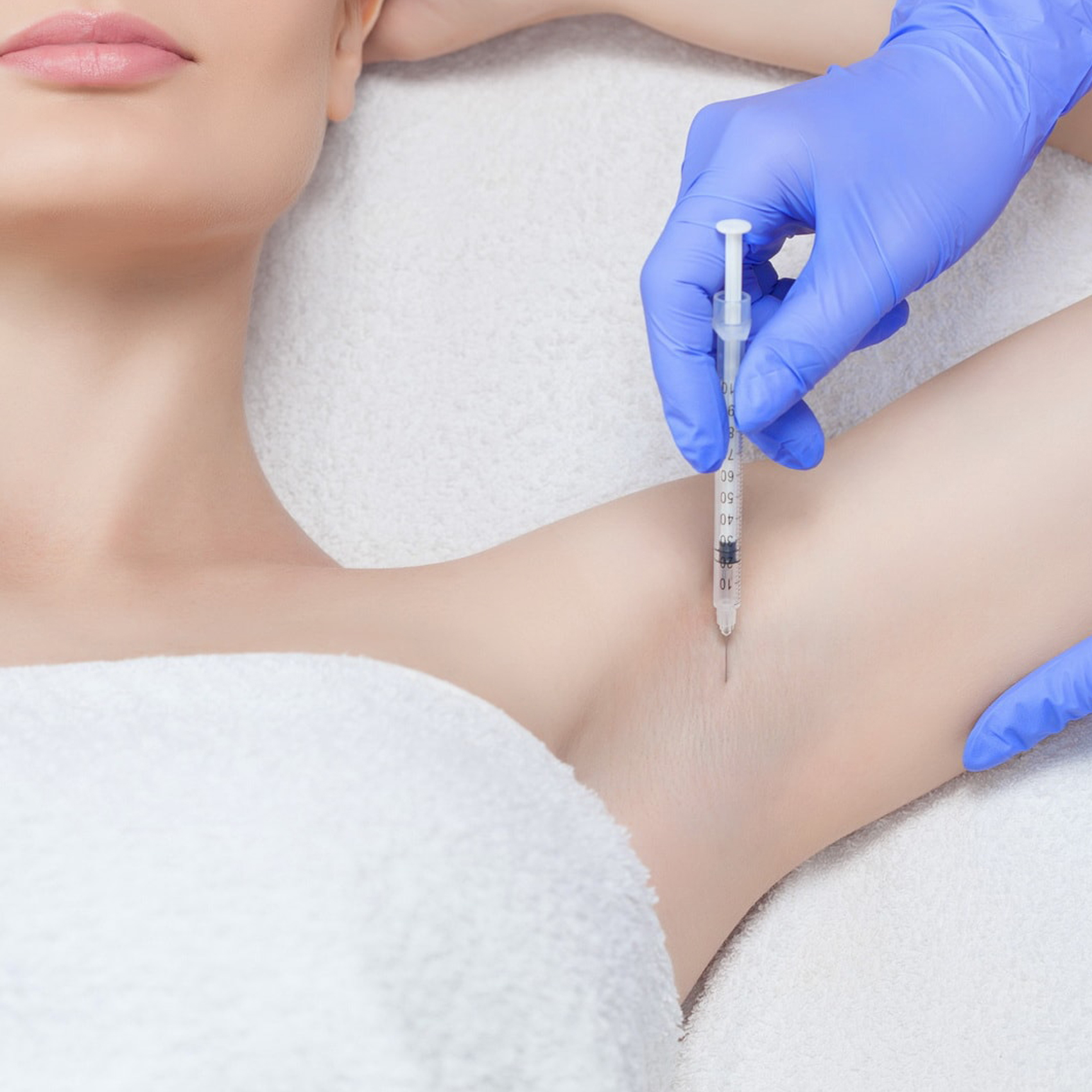 Hyperhidrosis Botox (Underarm Botox)