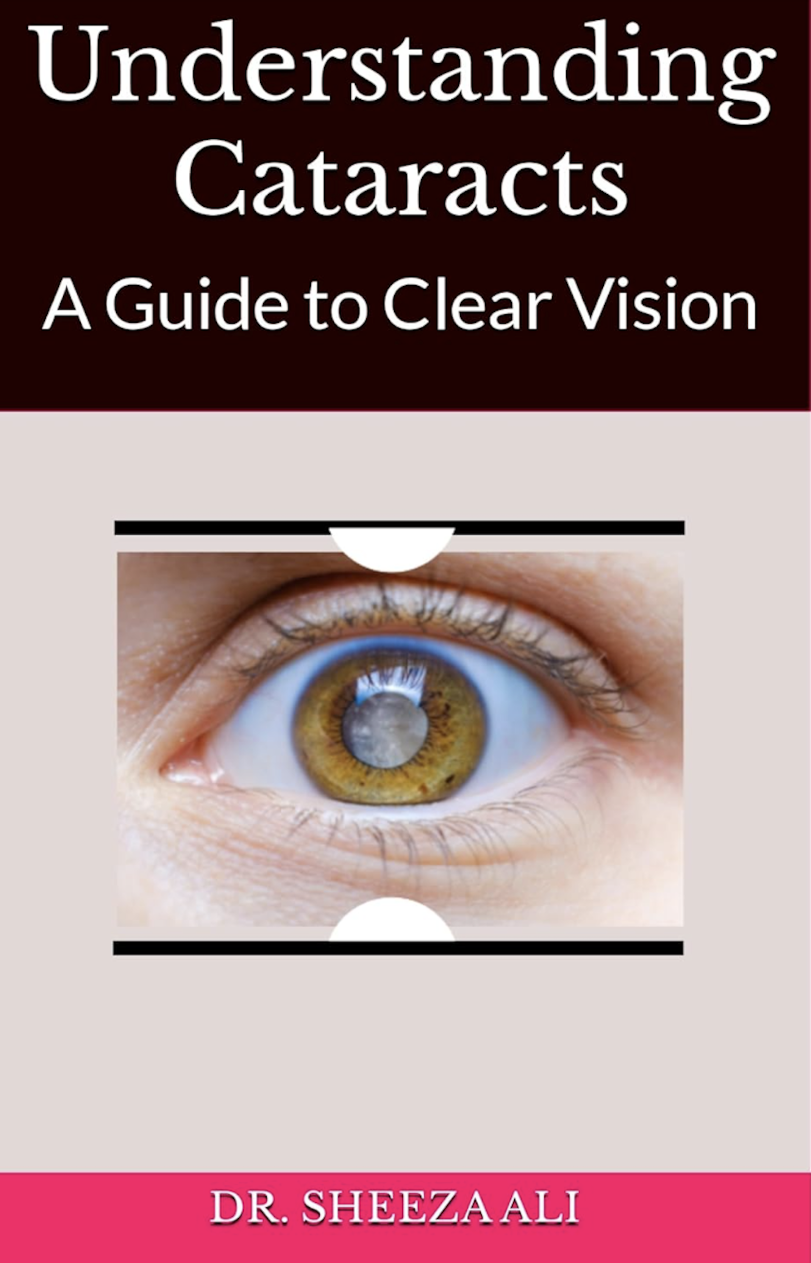 Understanding Cataracts