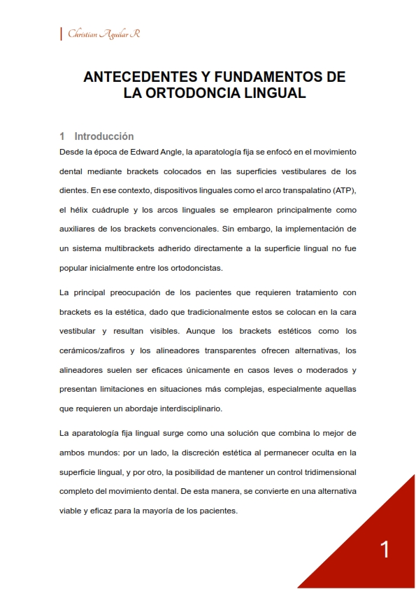 Ortodoncia Lingual