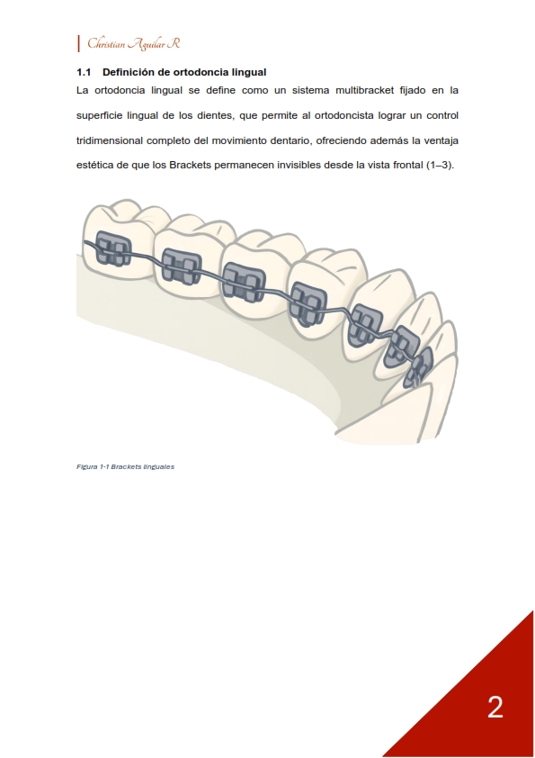Ortodoncia Lingual