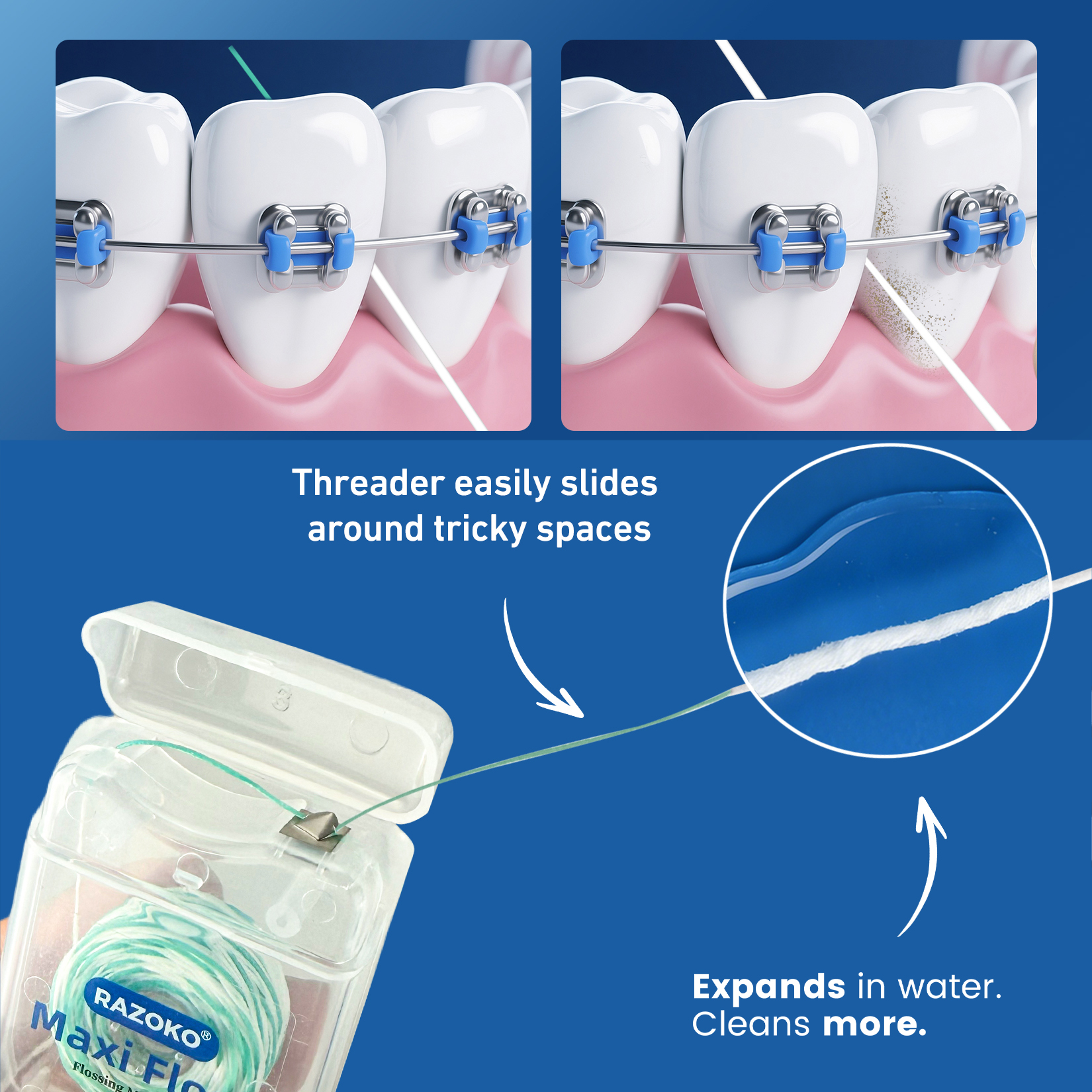 RAZOKO Threader Floss for Braces,Implants,Bridges-260 Count Pre-Measured Strands 2-in-1 Expanding Waxed Dental Floss for Deep Clean,Light Mint Flavored