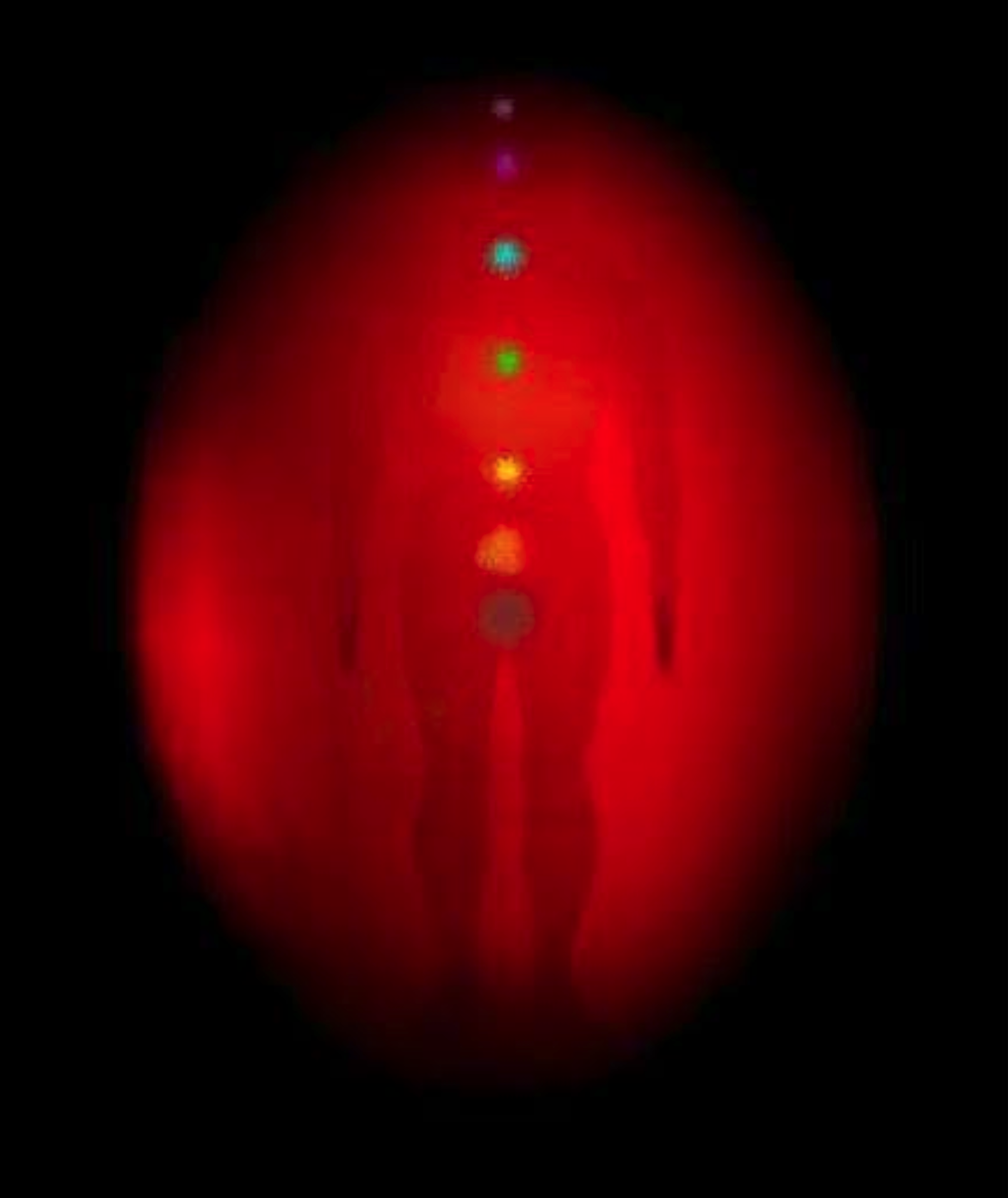 Auras foto