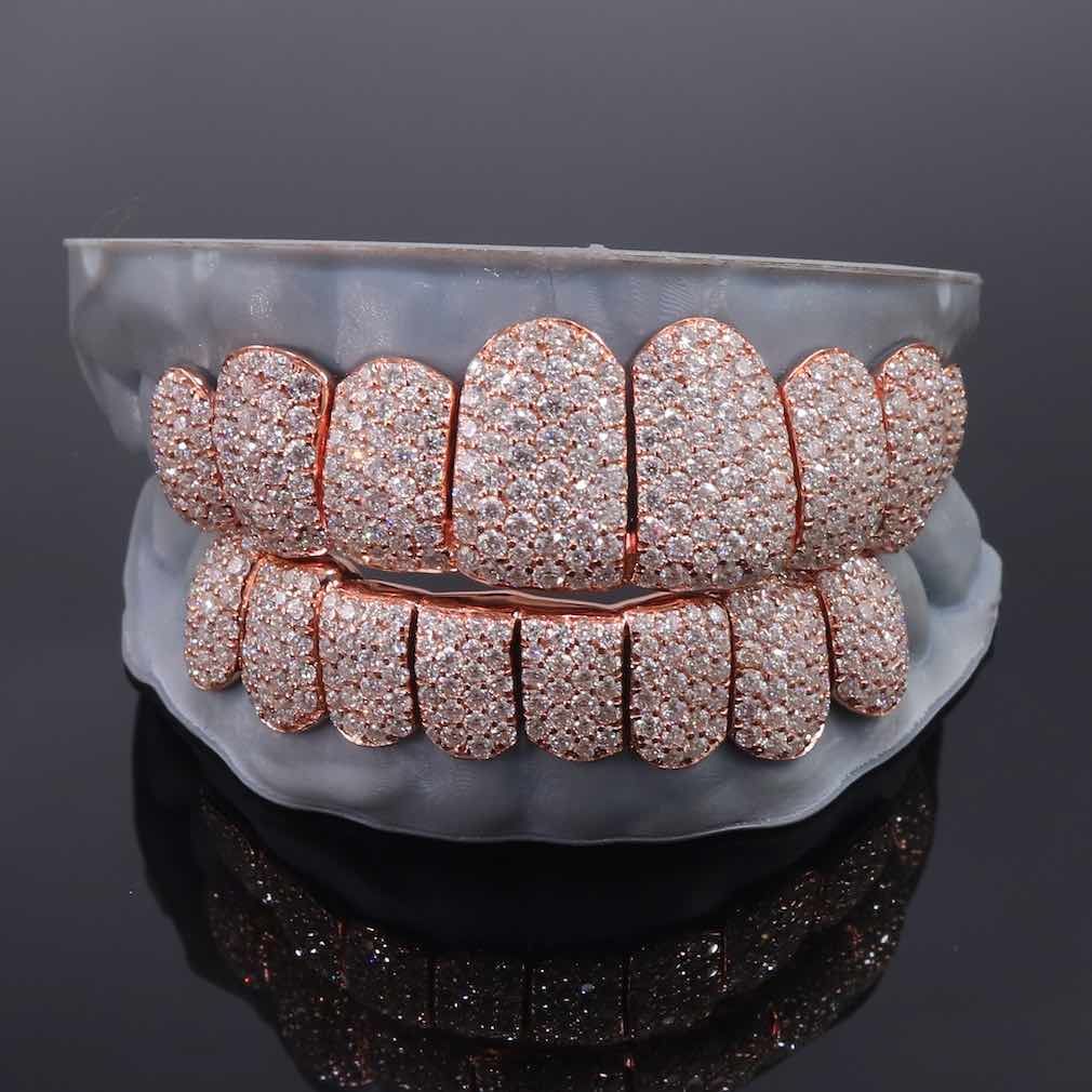 Diamond-Encrusted Gold Grillz