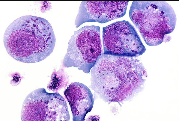Total Leucocyte Count