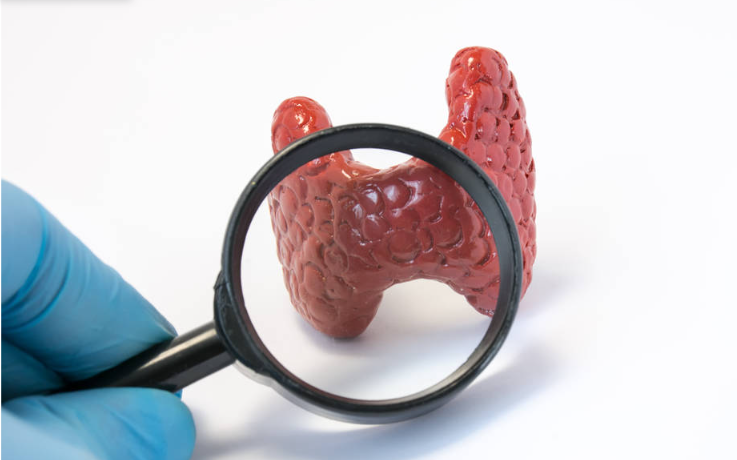 Thyroid Profile