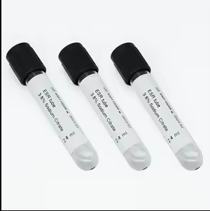 Erythrocyte Sedimentation Rate