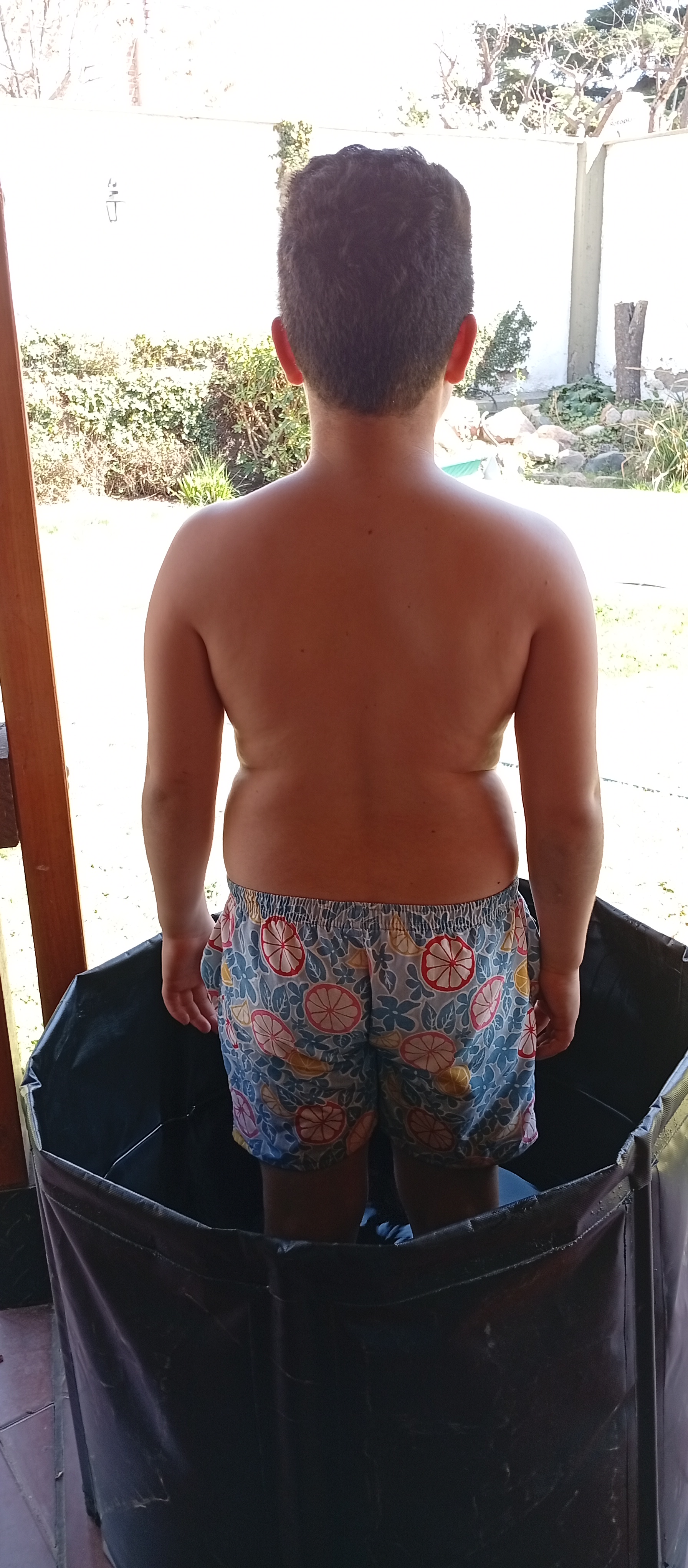 Piletas de crioterapia. 