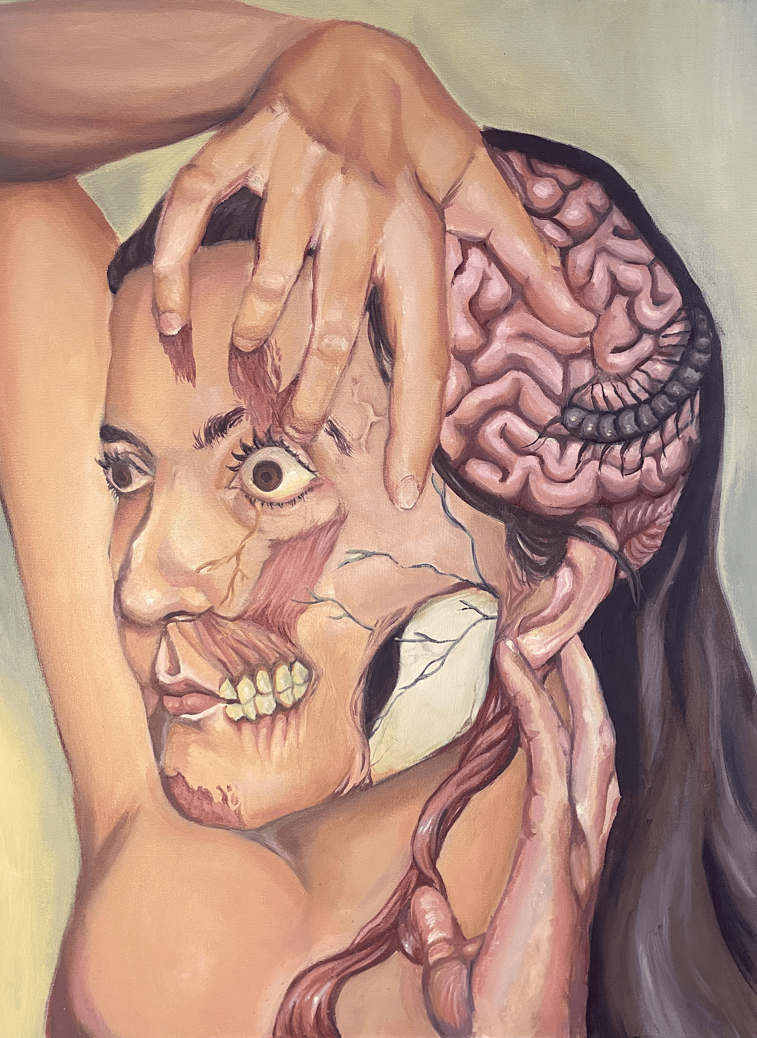Parasite