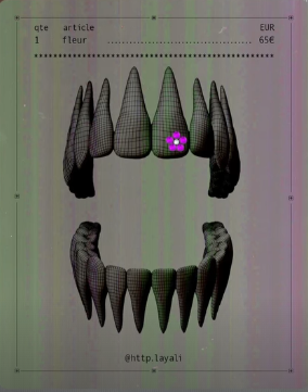 Gems Dentaires Luxueuses