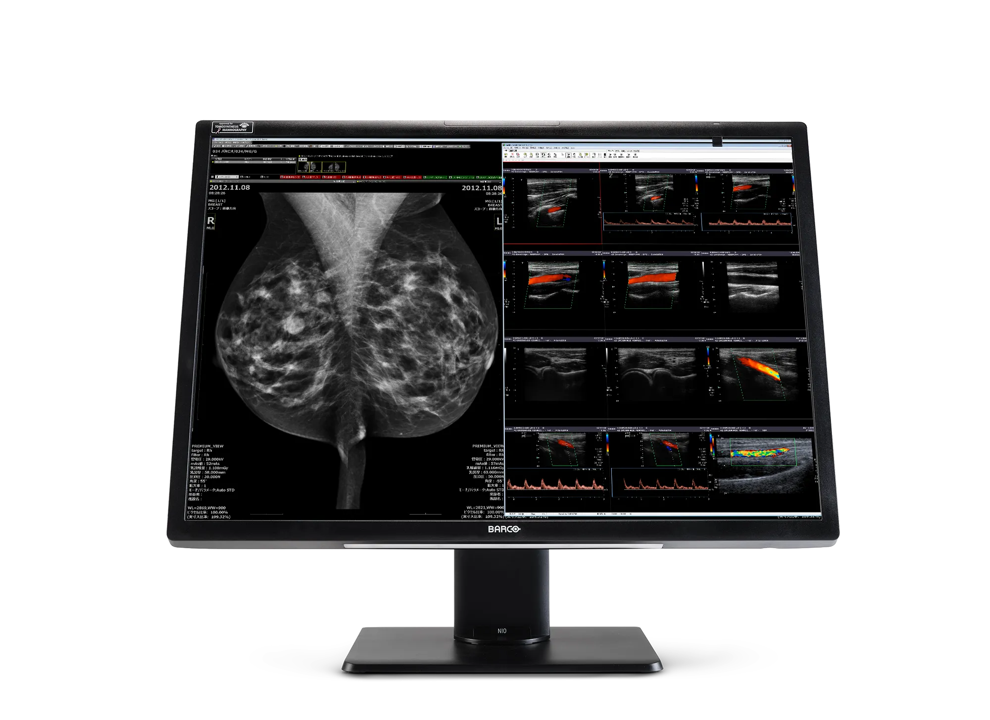 Nio Fusión 12MP (MDNC‑12130)
