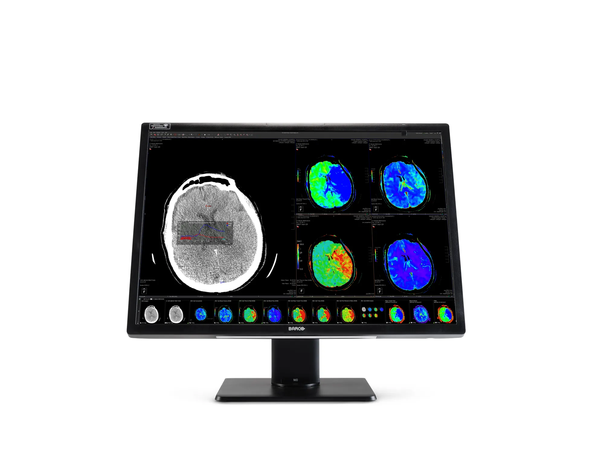 Nio Fusión 12MP (MDNC‑12130)