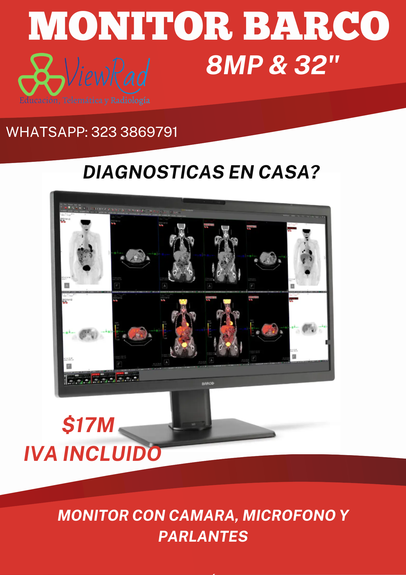 Monitor Barco Telerradiologia: Eonis Color 8MP (MDRC‑8132)