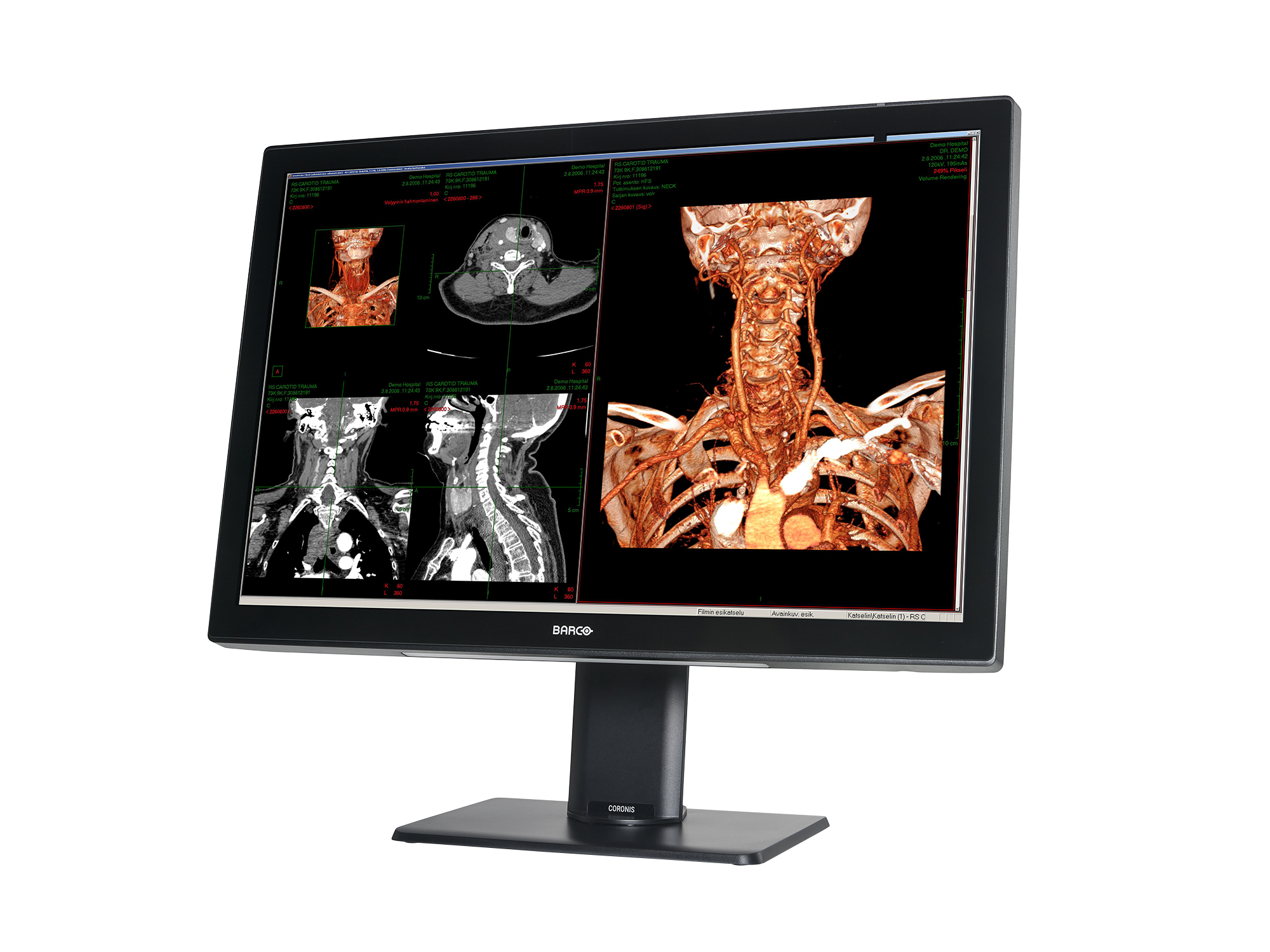 Coronis Fusion 6MP (MDCC‑6530)