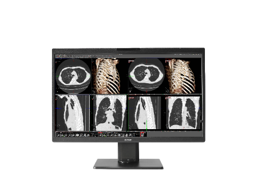 Monitor Barco Telerradiologia: Eonis Color 8MP (MDRC‑8132)