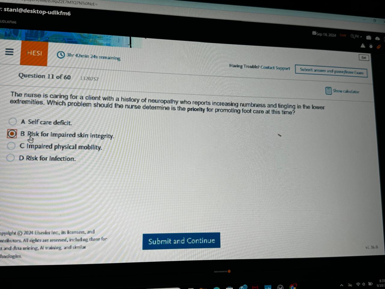  Foundations of Nursing (D439) OA 2