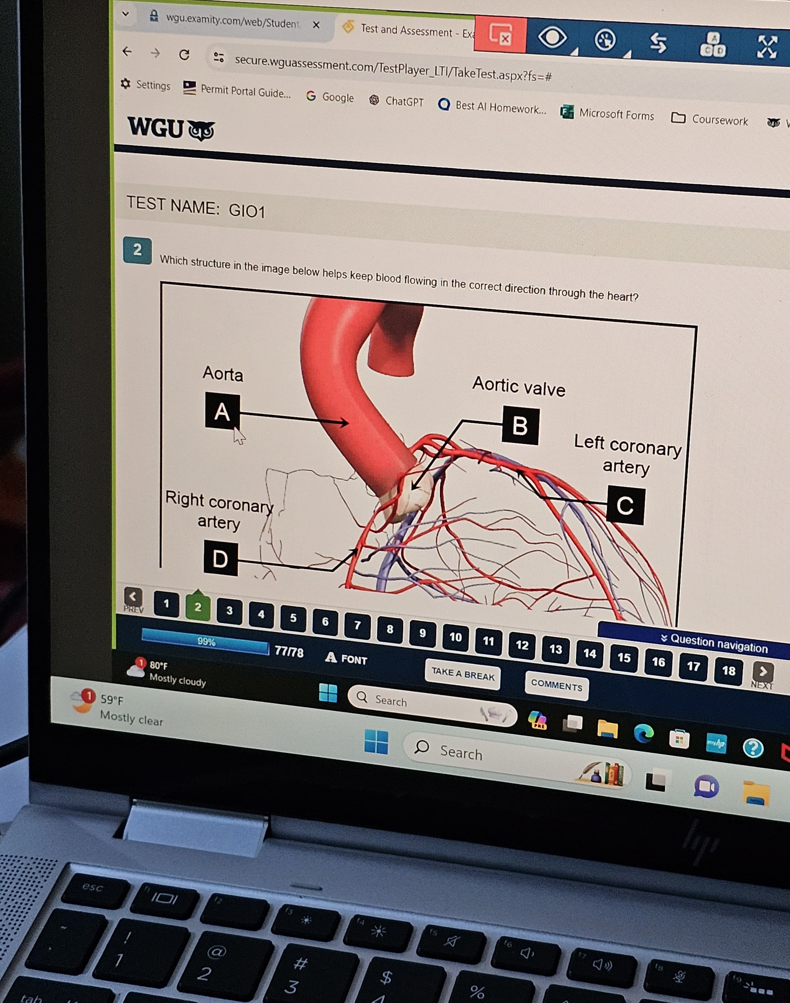 Anatomy and Physiology II with LAB (D313) Study Guide New OA2