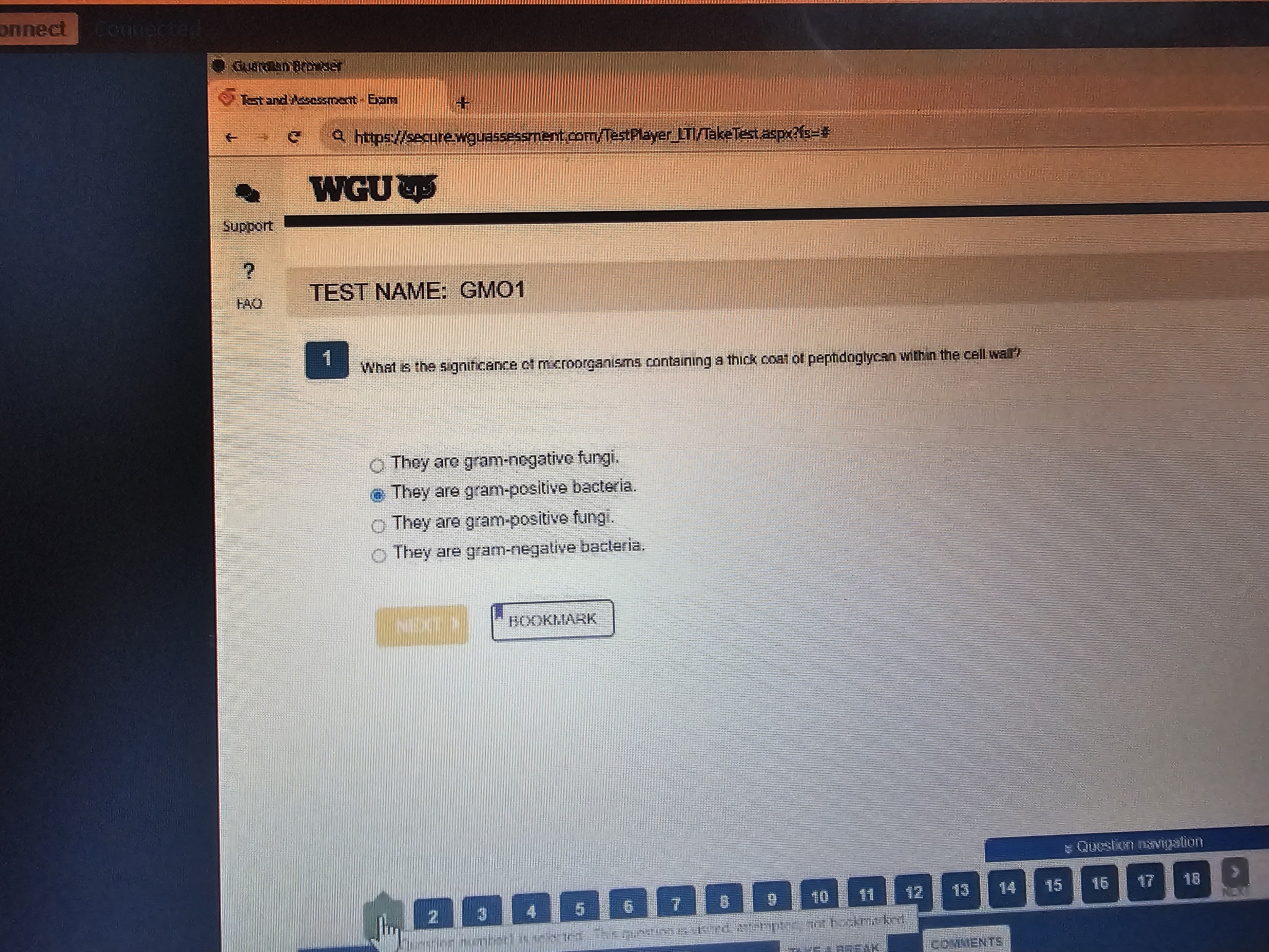 Microbiology (D311) OA