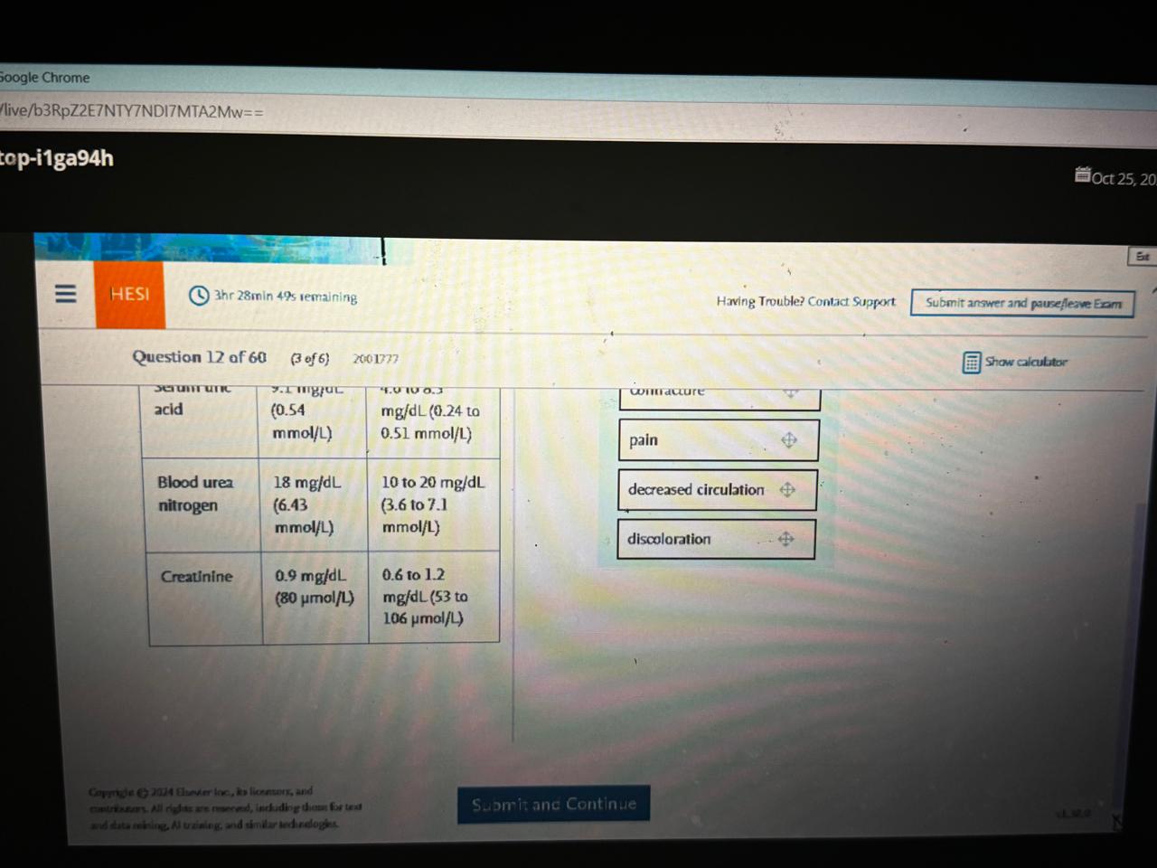 Adult Health II (D446) – OA 2