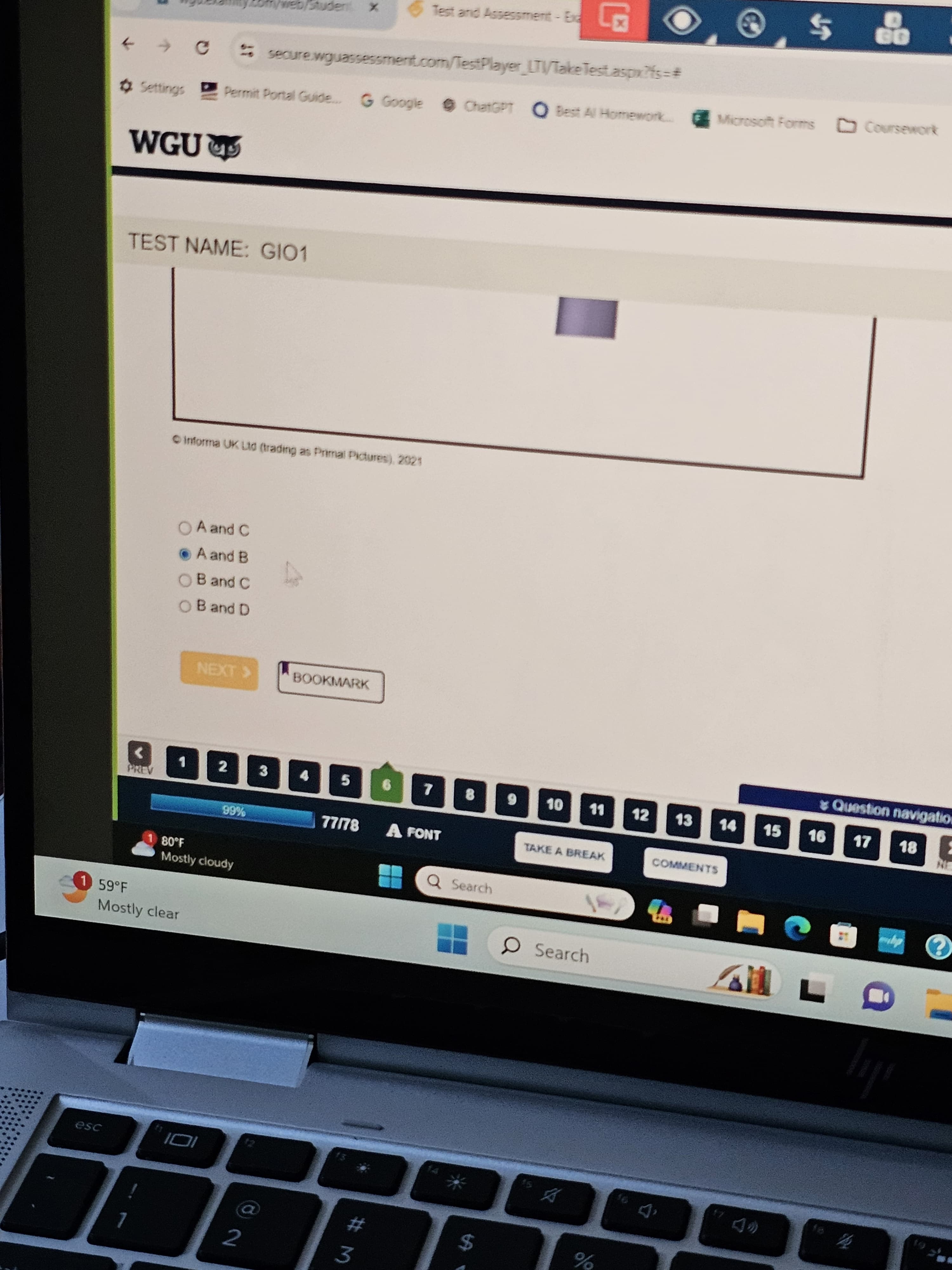 Anatomy and Physiology II with LAB (D313) Study Guide New OA2