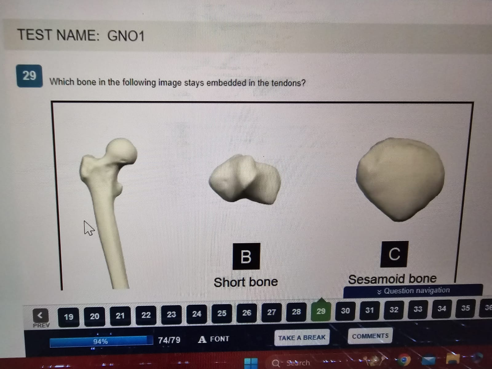 Anatomy and Physiology I with LAB (D312)