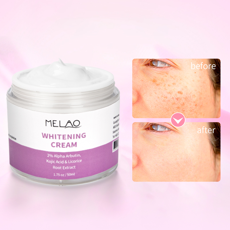 Whitening Cream - Pigment Vlekken Crème 50 ml