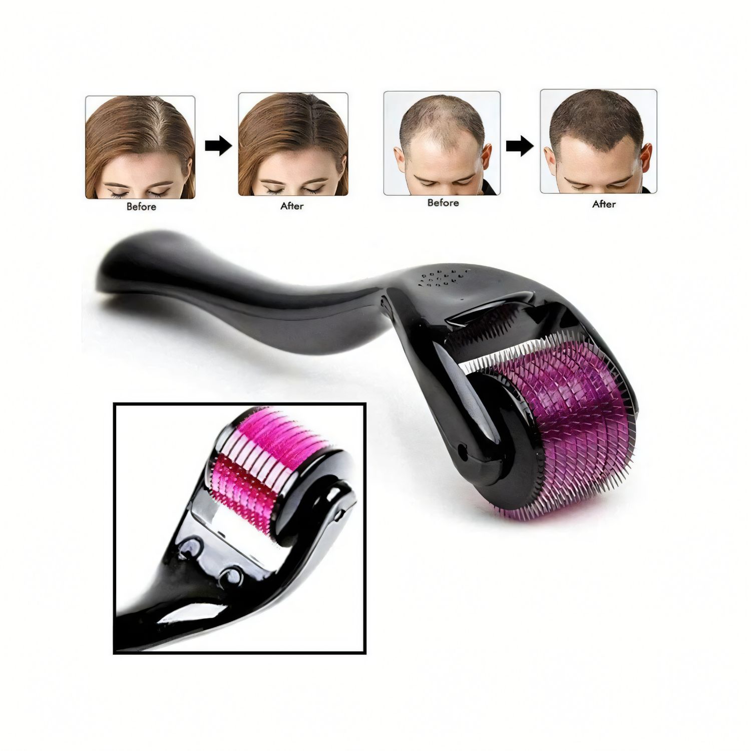 Dermaroller ZGTS 540 Naaldjes