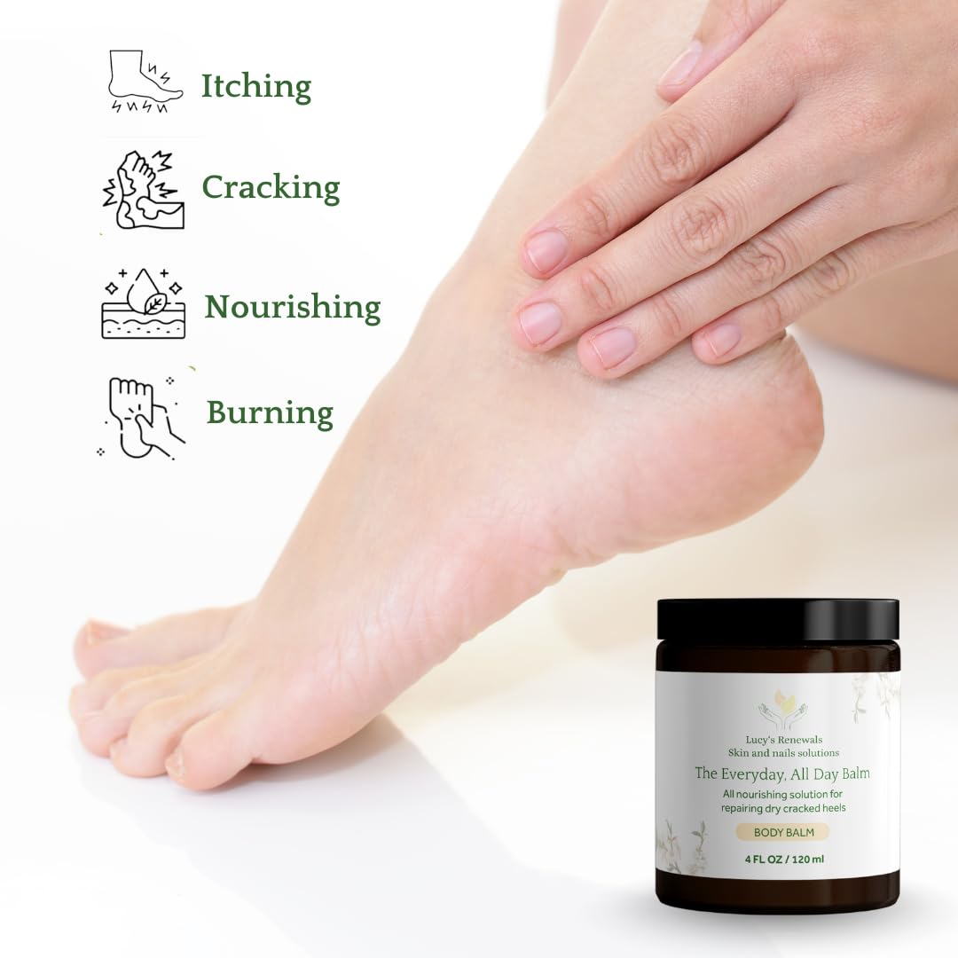 The Everyday, All Day Balm – Intense Moisturizer for Cracked Heels, Dry Skin & Body Care