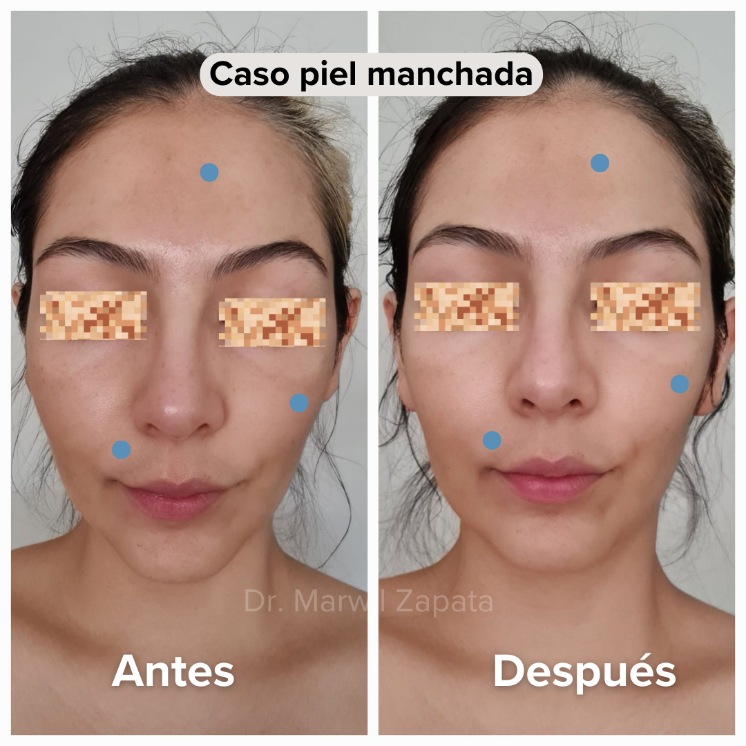 SKINCARE CON PROPÓSITO