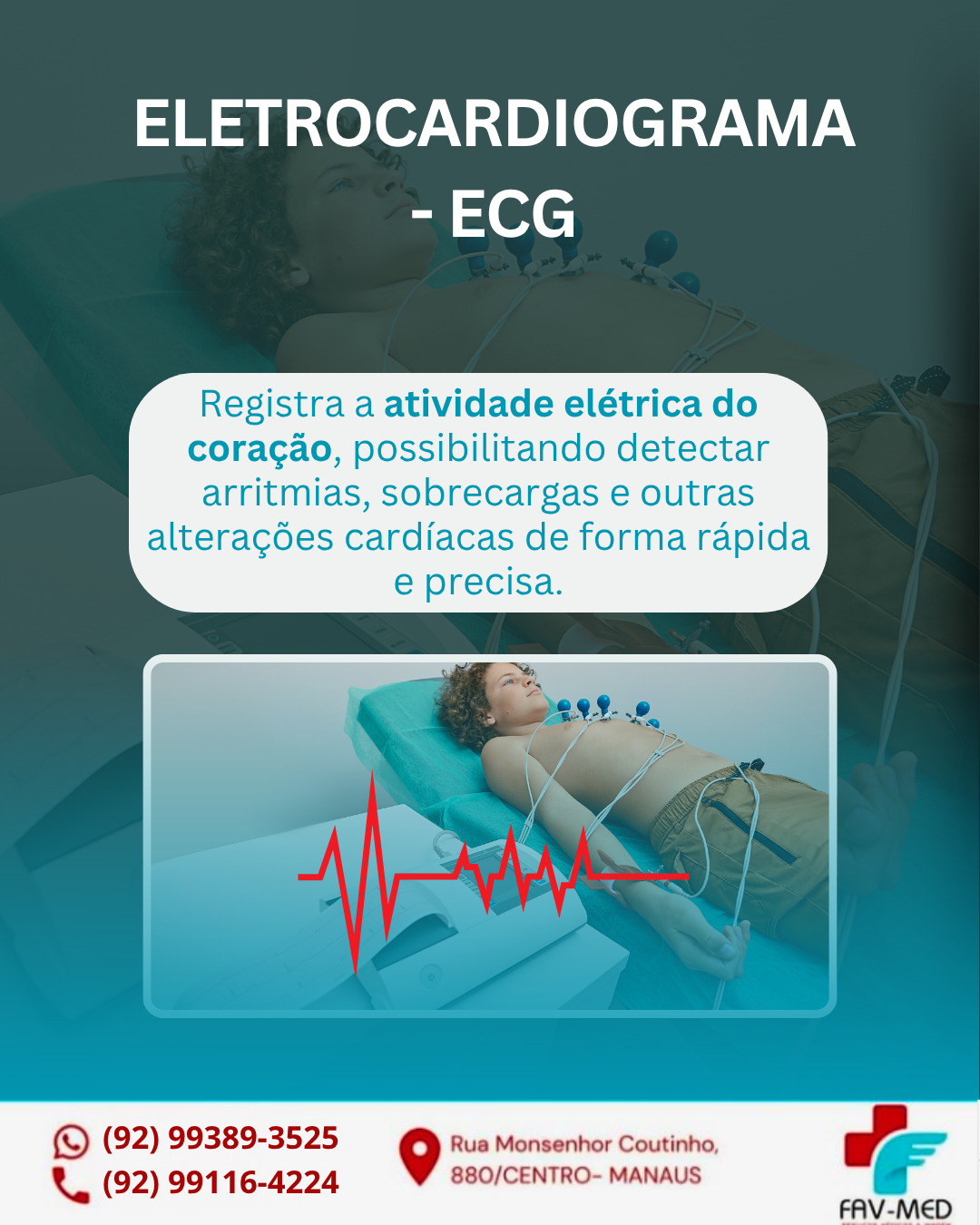 Eletrocardiograma - ECG