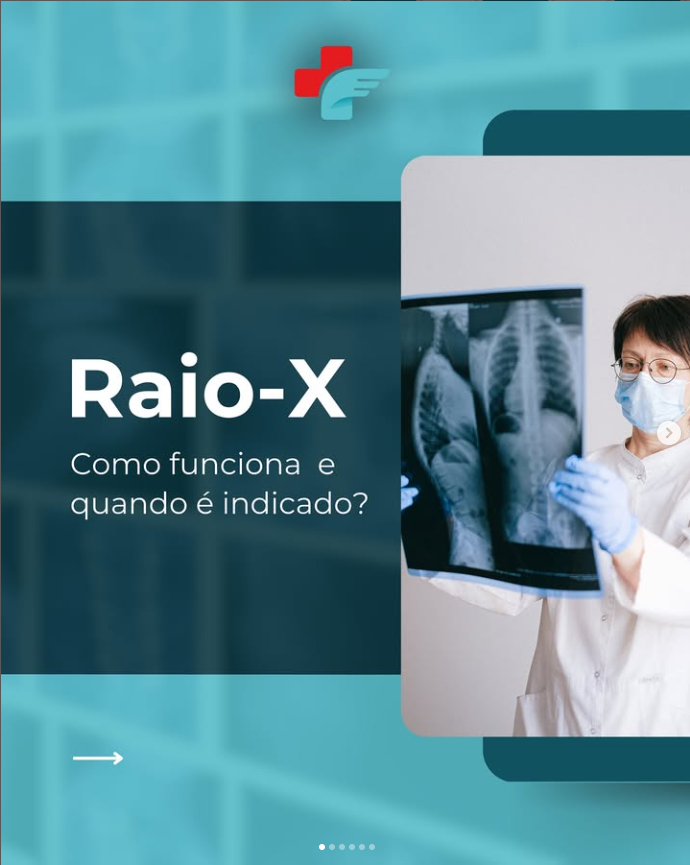 Raio-X