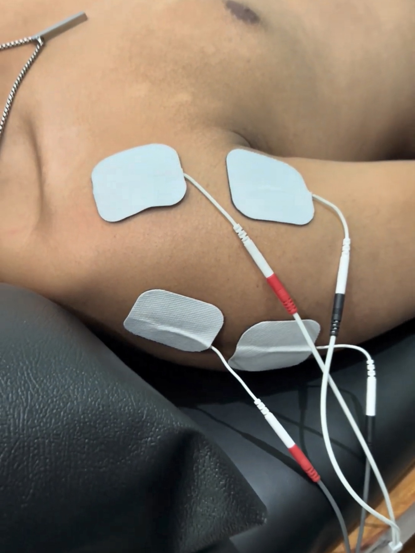 1 Session Physiotherapy 