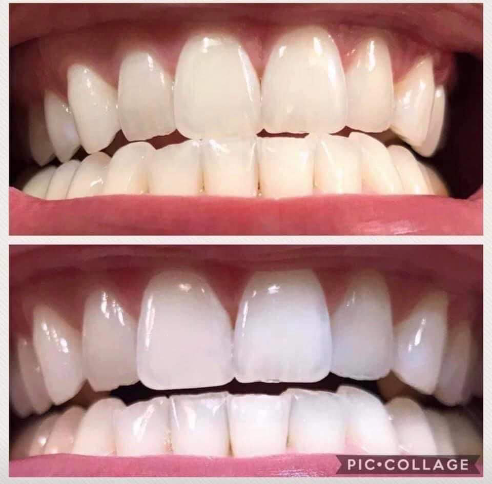 Whitening Toothpaste