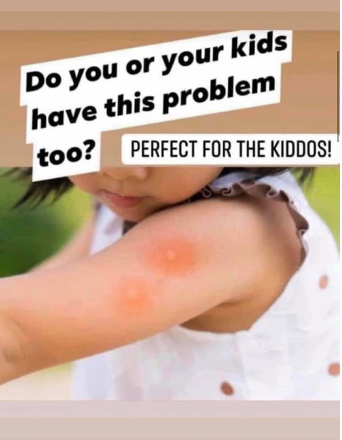Mosquito Repellent/Bite Healer